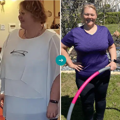 Renate: Vorher-Nachher-Vergleich, 41 Kilogramm abgenommen
