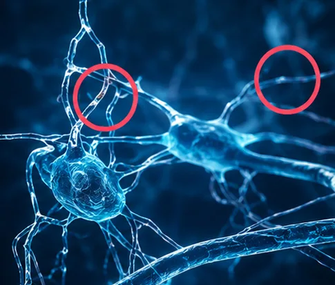 Illustration erster neuer neuronaler Verknüpfungen nach zwei Wochen mentalem Training